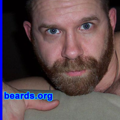 Steven's beard growth