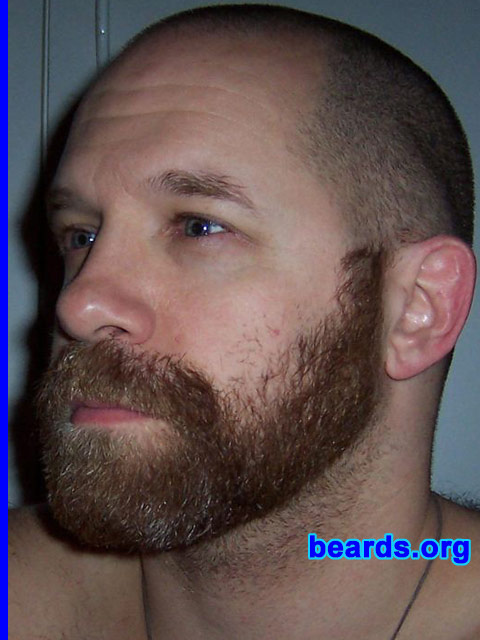 Steven's beard growth