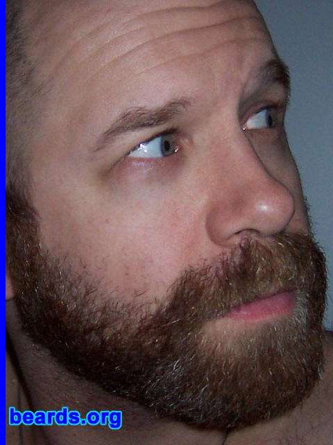 Steven's beard growth