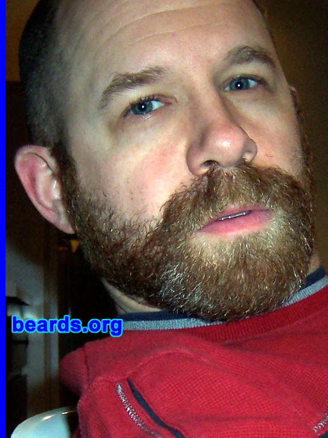 Steven's beard growth