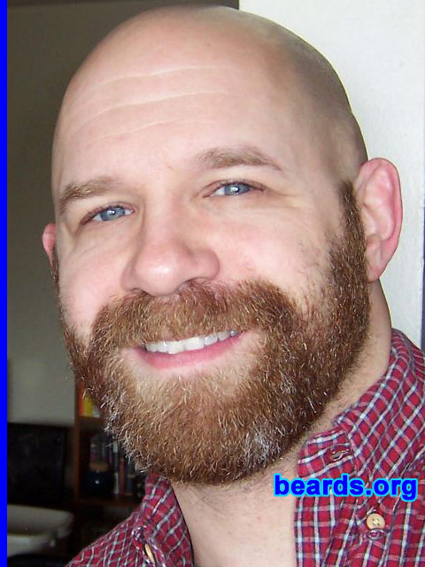 Steven's beard growth