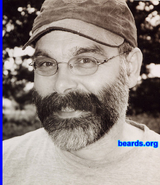 Michael's beard