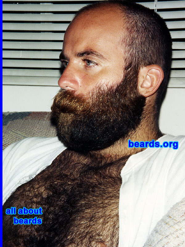 a truly outstanding beard