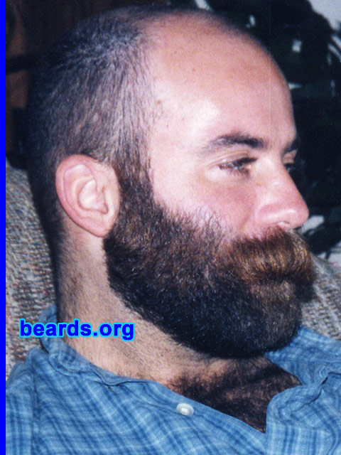 a truly outstanding beard