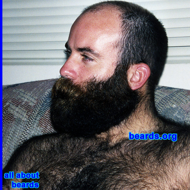 a truly outstanding beard