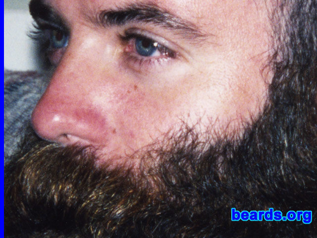 a truly outstanding beard