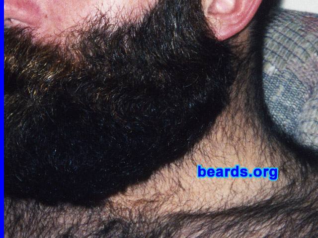 a truly outstanding beard