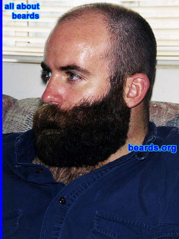 a truly outstanding beard
