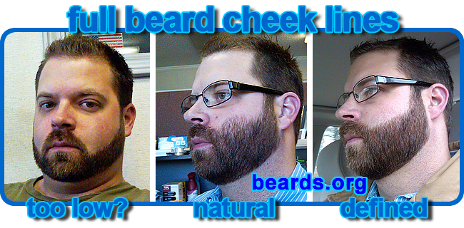 full beard cheek lines full beard cheek lines