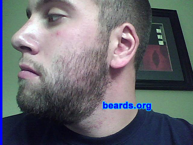 Andrew
Bearded since: 2006.  I am a dedicated, permanent beard grower.

Comments:
I grew my beard because BEARDS RULE.

How do I feel about my beard?  Can't wait for it to get longer and thicker.
Keywords: stubble full_beard