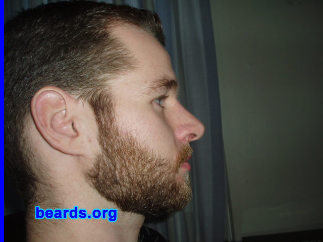 Patrick
Bearded since: 2008.  I am an experimental beard grower.

Comments:
I always knew someday I would let my beard grow to see how it looked on me. There was no real reason why.  It just was the right time to let it grow.

How do I feel about my beard?  Loving it.
Keywords: full_beard