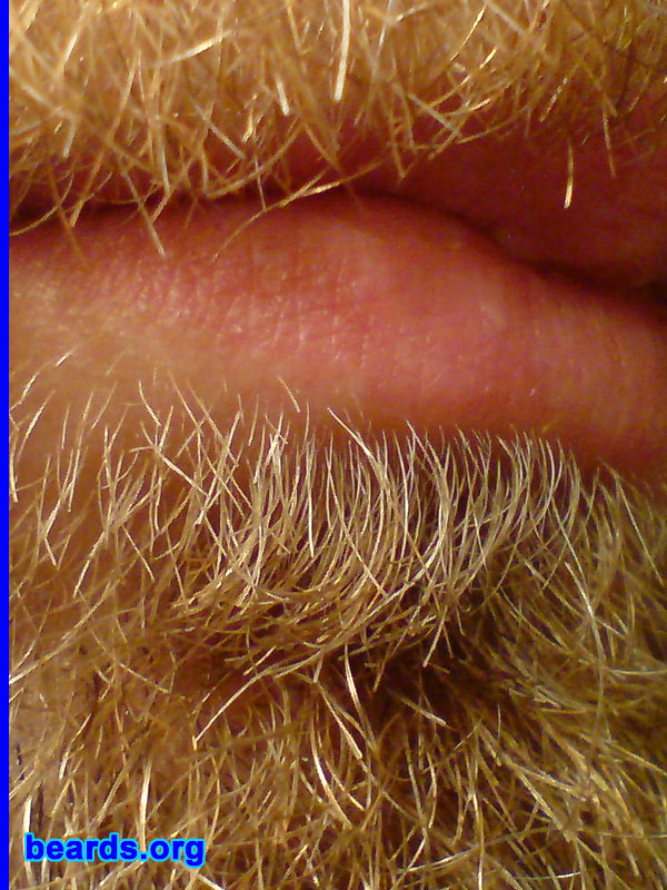 David
beard closeup

[b]Go to [url=http://www.beards.org/david.php]David's success story[/url][/b].
Keywords: dl.2006 macro full_beard