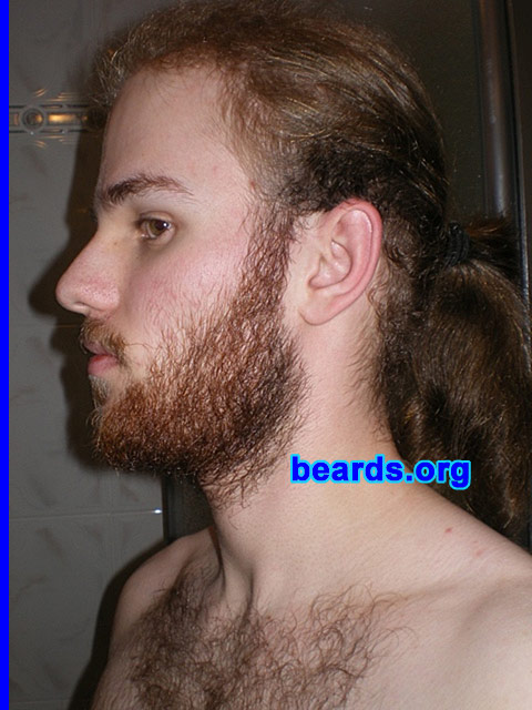 Michael
Update: July 2007.

[b]Go to [url=http://www.beards.org/michael.php]Michael's success story[/url][/b].
Keywords: full_beard