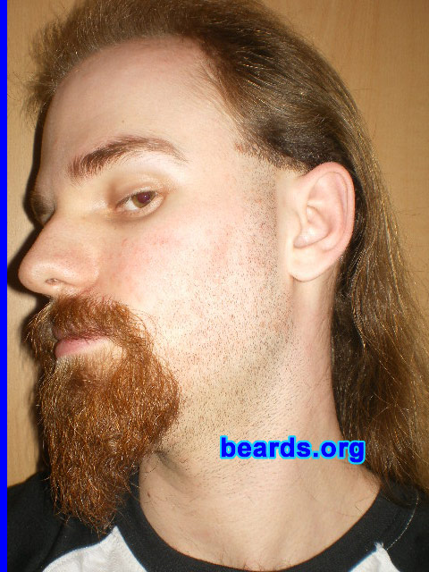 Michael
2010 new full beard: day 1

[b]Go to [url=http://www.beards.org/michael.php]Michael's success story[/url][/b].
Keywords: michael20052010 goatee_mustache stubble
