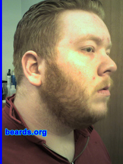 Thomas Hansen
Bearded since: 2001.  I am an occasional or seasonal beard grower.

Comments:
I grew my beard because beard is for real man, as simple as that.

I love it.  Can't live without it.
Keywords: full_beard