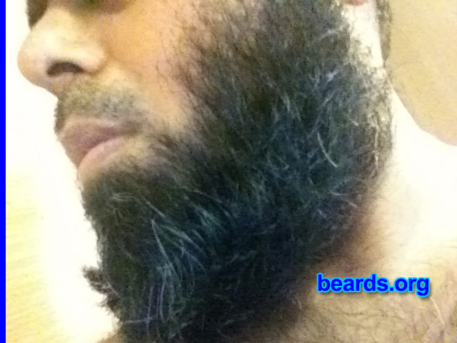 Osman S.
Bearded since: 2001. I am a dedicated, permanent beard grower.

Comments:
Why did I grow my beard?  Because it's a natural thing to do.  Men should grow beards!

How do I feel about my beard?  Love it.  Wish to keep it longer!
