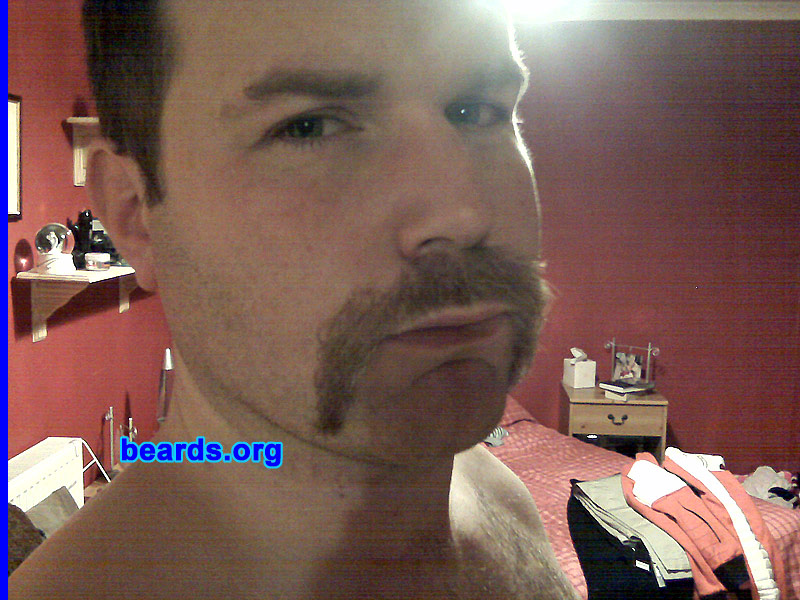 Alan M.
Bearded since: 1992.  I am an occasional or seasonal beard grower.

Comments:
I grew my beard because I am always trying new styles.

How do I feel about my beard?  Lacks thickness.  Would prefer to have black hair on face!!
Keywords: horseshoe