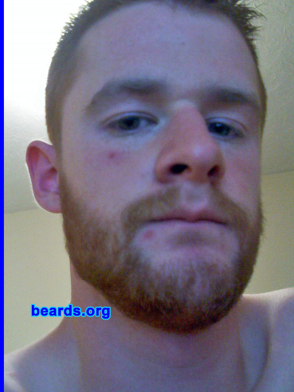 Adam F.
Bearded since: 2010.  I am an occasional or seasonal beard grower.

Comments:
I grew my beard because I like the look and feel of my beard. Why prohibit something that occurs naturally?

How do I feel about my beard? I am satisfied with my beard.
Keywords: full_beard