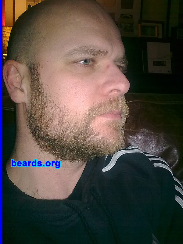 Chris
Bearded since: 2008.  I am a dedicated, permanent beard grower.

Comments:
I have always had long stubble, but my wife convinced me to grow my beard.  I think I look better with a beard than without.

How do I feel about my beard? I like it. It does take dedication, though, as I have always gotten to the itchy stage and then shaved it off. My new year's resolution is not to shave it off in 2010...  Let's see...
Keywords: full_beard