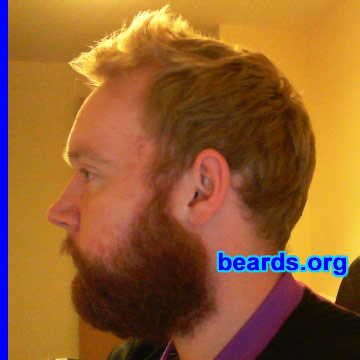 Frankie B.
Bearded since: 2011. I am an experimental beard grower.

Comments:
I have always had the urge to grow my beard but either people, jobs, or even family got me to shave it off. I'm now in a job where I can do what I want and have more of a focus on growing it now that I ever did! Also, being Scottish I was influenced by big Hamish out of Braveheart! Haha!

How do I feel about my beard? I like it.  At times I struggle as to whether I should keep it or not. If it weren't for a weak mustache I'd grow it for years. Also, I have a bit of a birth mark on my right cheek which I think affects (on that side) how high my cheek-line growth is. All in all, I'm happy with it for the moment. Just waiting on the mustache to catch up! :)
Keywords: full_beard