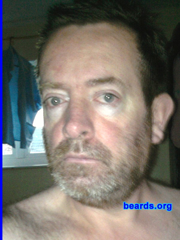 Pete K.
Bearded since: 2011. I am an occasional or seasonal beard grower.
Keywords: stubble full_beard