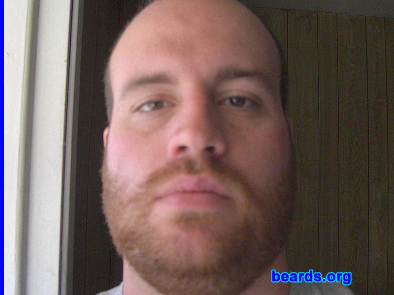 Travis R.
Bearded since: 2010. I am a dedicated, permanent beard grower.

Comments:
I grew my beard because I felt shavers cost too much and I look good with one anyway.

How do I feel about my beard? Great. It gives me that pioneer look I want. 
Keywords: stubble full_beard