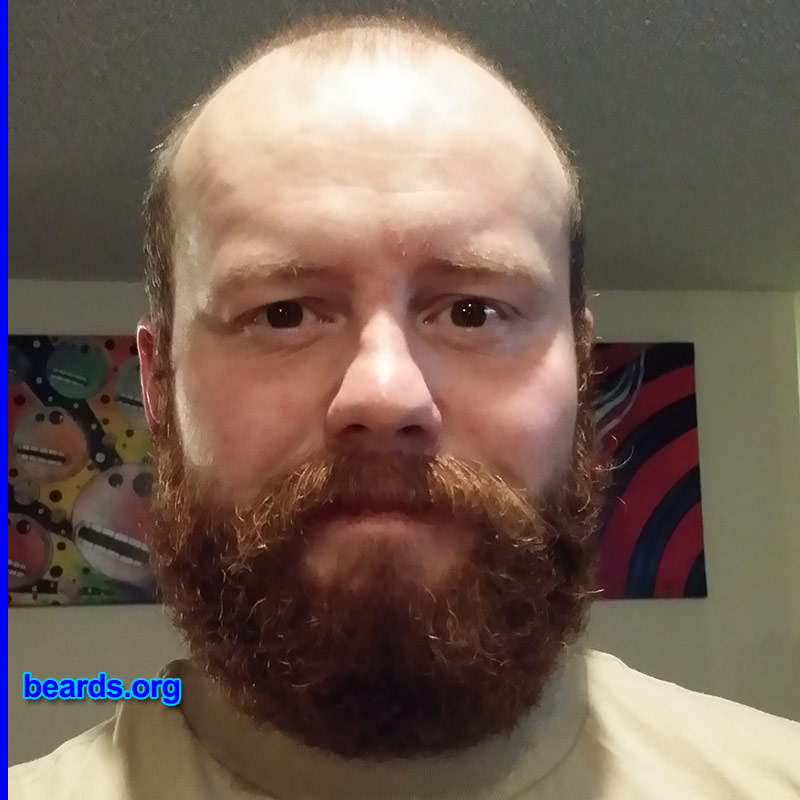 Dustin
Bearded since: 2013. I am a dedicated, permanent beard grower.

Comments:
Why did I grow my beard? First chance I've had to just let the beard do its thing.

How do I feel about my beard? I love my beard! Reminds me to relentlessly be a man.
Keywords: full_beard