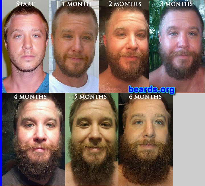 Drew
Bearded since: 2006. I am an occasional or seasonal beard grower.

Comments:
Why did I grow my beard? For a challenge and social experiment.

How do I feel about my beard? It has grown on me. Lots of negative reactions. I've been called "homeless", "ZZ Top", "Moses", "Duck Dynasty", "mountain man", and asked at least one hundred times, "Why are you growing a beard?". I answer "I'm not growing a beard. I'm just not shaving." I even got into a blown-up altercation with my in-laws and my beard was mentioned as a reason they don't like me. On the positive side, even the girls who say they don't like it seem to be subconsciously attracted to it. I seem to get more respect and less "lip" from guys.
Keywords: full_beard