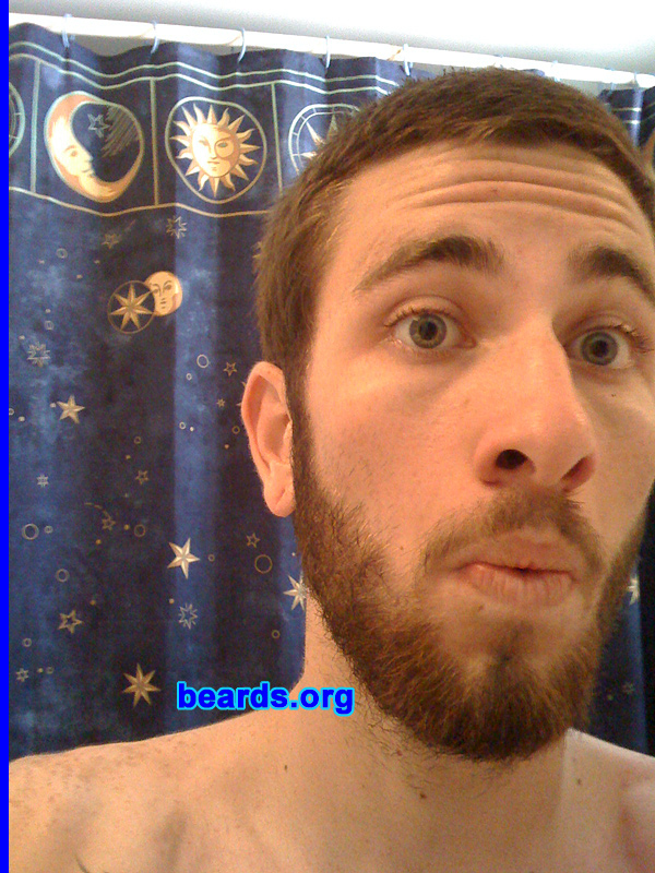 Travis
I am a dedicated, permanent beard grower.

Comments:
As a wee baby, I always saw myself as being bearded. And after many struggles of not being able to, I stand here today...BEARDED.

How do I feel about my beard?  I love it, and all its uniqueness!  Oh, and that spot under my chin needs to fill in. PLEASE.
Keywords: full_beard