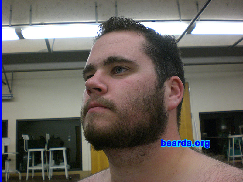 Patrick M.
Bearded since: 2008.  I am an occasional or seasonal beard grower.

Comments:
I grew my beard to attempt to make my face slimmer.

How do I feel about my beard?  It hurts because my hair grows left to right and pokes me 24/7.
Keywords: full_beard
