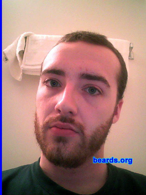 John Q.
Bearded since: 2001.  I am a dedicated, permanent beard grower.

Comments:
I grew a beard because I just don't look right without one.

How do I feel about my beard?  My beard is amazing. It makes me feel like I have super powers.  It gets me respect from everyone.
Keywords: full_beard