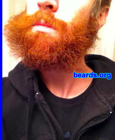 Austin H.
Bearded since: 2004. I am a dedicated, permanent beard grower.

Comments:
Why did I grow my beard?  It's been so long I have forgotten the original reason that I started, other than seeing my dad shave as a kid.  I thought, I never want to do that!

How do i feel about my beard? I feel great about my beard.
Keywords: full_beard