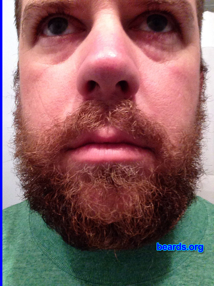 Patrick L.
Bearded since: 2013. I am an experimental beard grower.

Comments:
Why did I grow my beard? Just to see if I could.

How do I feel about my beard? It's here to stay.
Keywords: full_beard