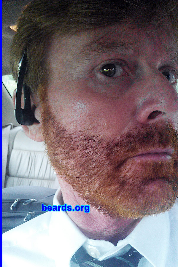 J.D.
Bearded since: 2010. I am an occasional or seasonal beard grower.

Comments:
I grew my beard for a change.

How do I feel about my beard? I like it fine. I just change my mind often whether to let it grow or shave it again.
Keywords: full_beard