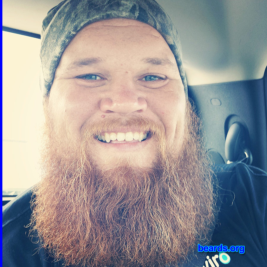 Robb
Bearded since: 2013. I am a dedicated, permanent beard grower.

Comments:
Why did I grow my beard? Got tired of shaving and I'm not a woman. :)

How do I feel about my beard? They call me red beard, blue eyes.
Keywords: full_beard