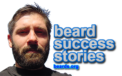 beard success stories