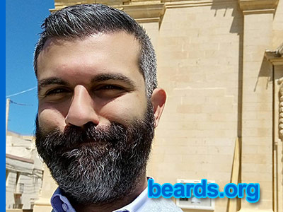 Jimmy's excellent, strong beard