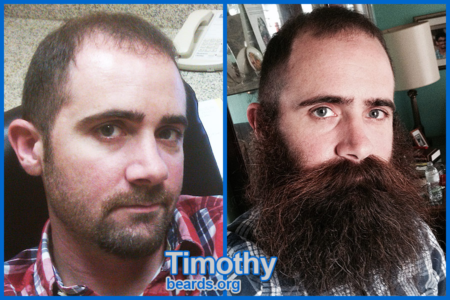 Timothy, before and after the beard