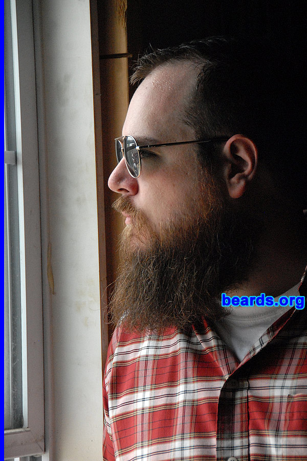 Alan
[b]Go to [url=http://www.beards.org/success_alan.php]Alan's success story[/url][/b].
Keywords: full_beard