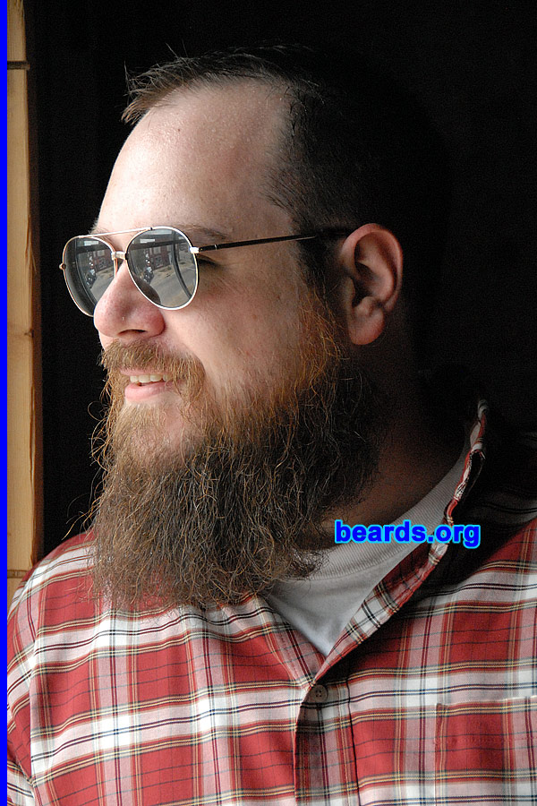 Alan
[b]Go to [url=http://www.beards.org/success_alan.php]Alan's success story[/url][/b].
Keywords: full_beard