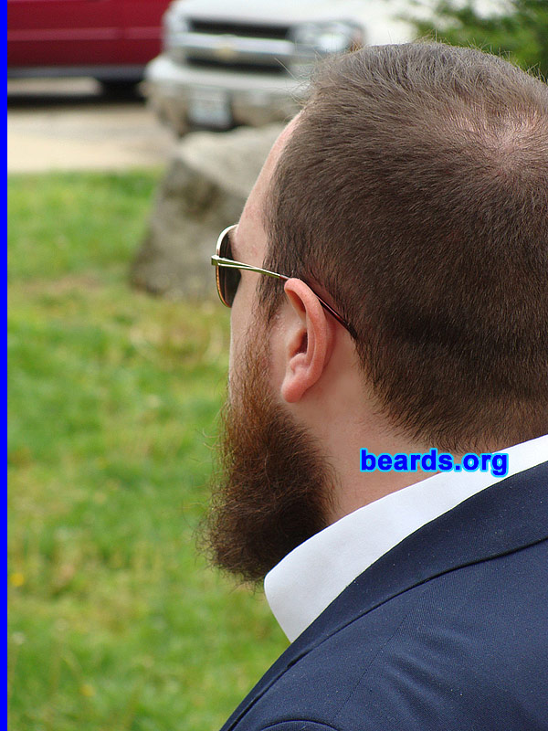 Alan
[b]Go to [url=http://www.beards.org/success_alan.php]Alan's success story[/url][/b].
Keywords: full_beard