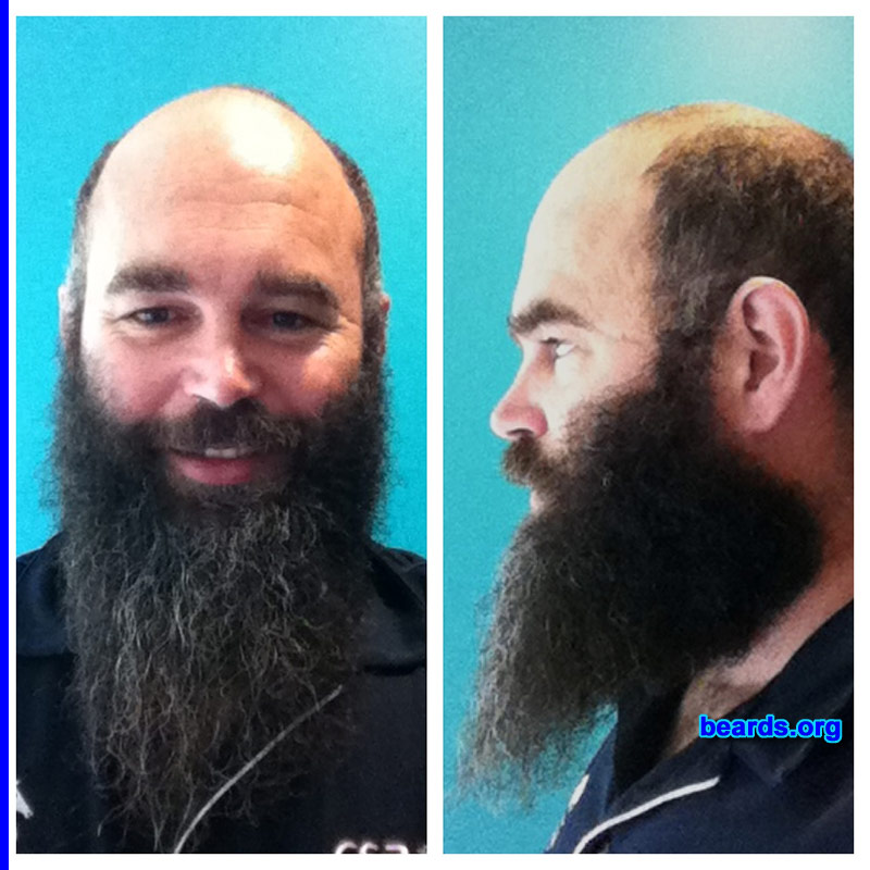 Dale
Bearded since: 2012. I am a dedicated, permanent beard grower.

Comments:
Why did I grow my beard? My wife loves it.

How do I feel about my beard? Needs to be longer.
Keywords: full_beard