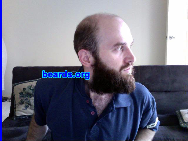 Norm
Bearded since: 2009.  I am a dedicated, permanent beard grower.

Comments:
Why did I grow my beard?  I didn't grow it. God, nature, or whatever you believe in grew it.

How do I feel about my beard?  I feel good.  My wife loves it.  But I feel I am not being accepted because of it.
Keywords: full_beard