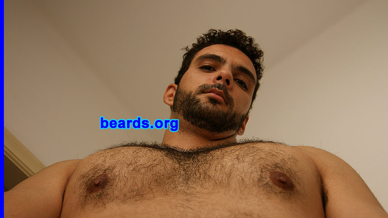 Felipe
Bearded since: age twenty-six.  I am a dedicated, permanent beard grower.

Comments:
I decided to assume my beard because of problems with shaving. I'm still thinking about using some skin treatment using laser only in my neck, because of spots.

How do I feel about my beard? I feel very well. I am proud of my beard. A beard makes a man more a man...
Keywords: full_beard