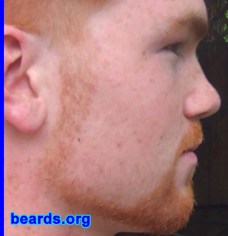 Tyler
I am an experimental beard grower.

Comments:
I grew my beard to see if I could.  Along with growing a nice full beard at a young age, I wanted to look older.

How do I feel about my beard?  Awesome, manly, and powerful.
Keywords: full_beard