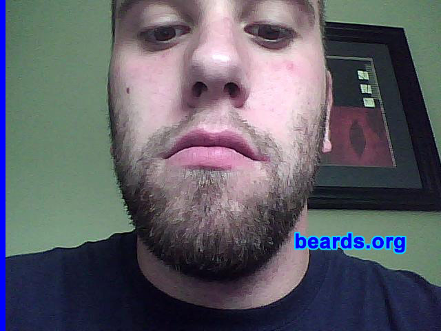 Andrew
Bearded since: 2006.  I am a dedicated, permanent beard grower.

Comments:
I grew my beard because BEARDS RULE.

How do I feel about my beard?  Can't wait for it to get longer and thicker.
Keywords: stubble full_beard