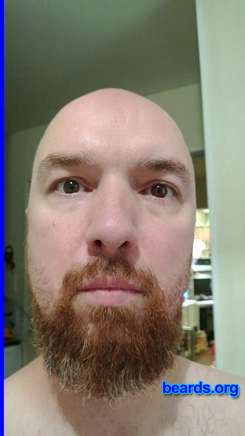 Tony S.
Bearded since: 1994. I am a dedicated, permanent beard grower.

Comments:
Why did I grow my beard? Fell in love with beards at a young age because of Santa, Gandalf, etc.

How do I feel about my beard? Love it.  Just wish cheek area grew in better.  Had full beard then shaved cheeks to try that but wasn't happy.  I am growing full again, slowly but surely.
Keywords: full_beard