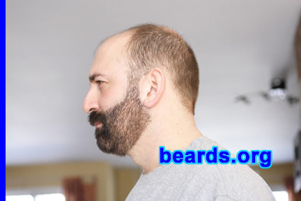 Hildon
Bearded since: 2006.  I am a dedicated, permanent beard grower.

Comments:
I grew my beard when I turned 40.

Love it.  Will never shave again.
Keywords: full_beard