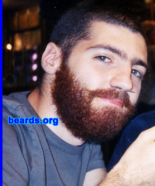 Dan
[b]Go to [url=http://www.beards.org/dan.php]Dan's success story[/url][/b].
Keywords: full_beard