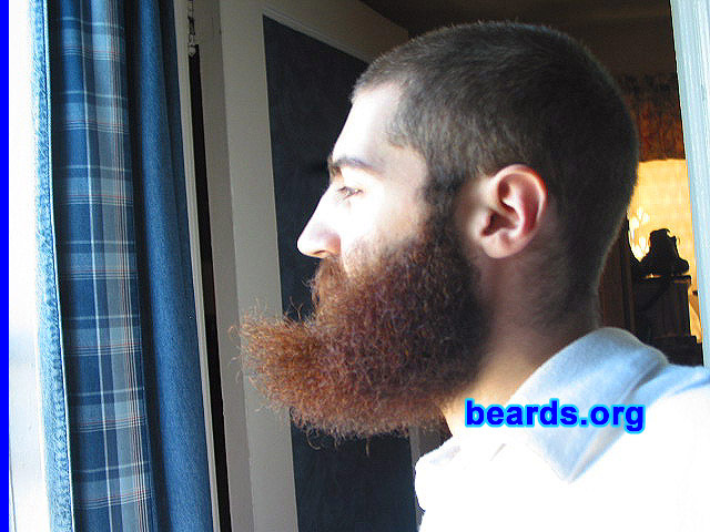 Dan
[b]Go to [url=http://www.beards.org/dan.php]Dan's success story[/url][/b].
Keywords: dan.002 full_beard